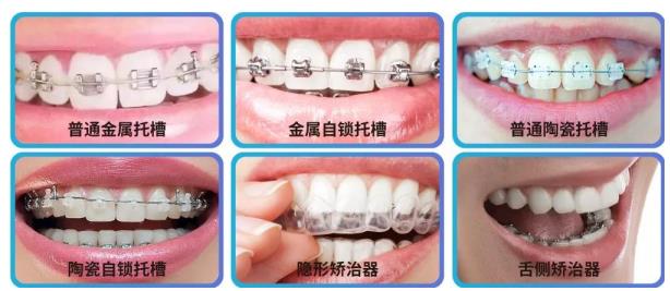 武漢德韓口腔暑期牙齒矯正口碑如何??jī)?yōu)質(zhì)技術(shù)品質(zhì)服務(wù)