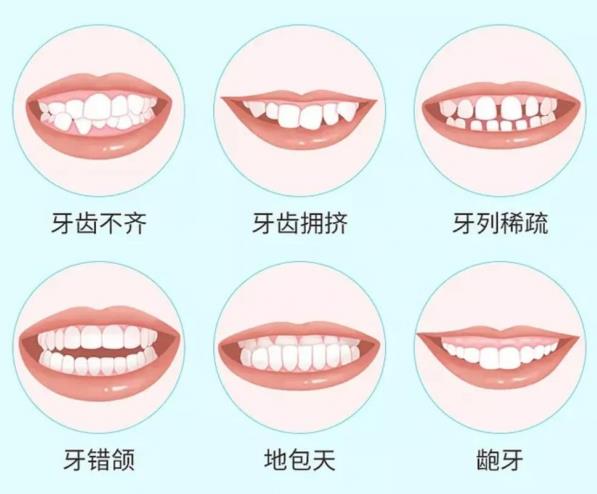 武漢哪個(gè)地方暑期牙齒矯正好?德韓口腔質(zhì)優(yōu)價(jià)廉
