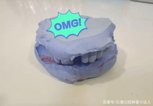 網(wǎng)友:缺牙怎么辦?武漢仁愛口腔種植專家?guī)睋舴N植手術(shù)現(xiàn)場,見證缺牙重生的秘密!