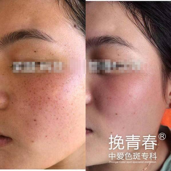 中愛·挽青春色斑專科,整合式皮膚醫(yī)學研究中心