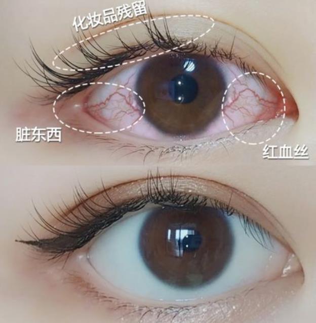 緩解眼干眼澀,眼用凝膠和眼藥水哪個好?