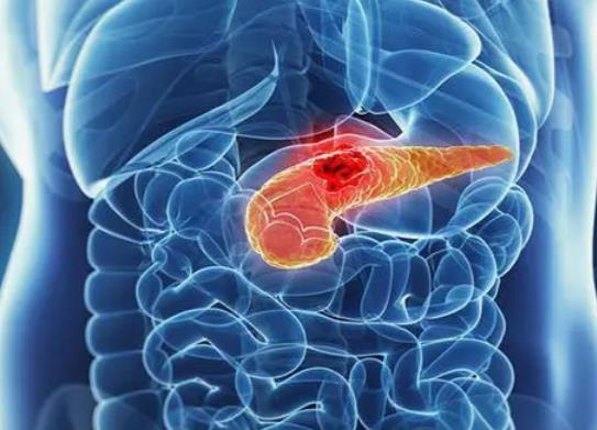 胰腺在人體的哪個部位圖解 胰腺的功能和作用