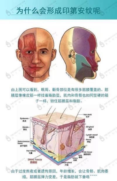 伊站醫美抗衰護理 印第安紋是哪個部位