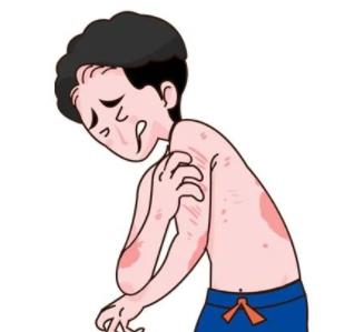 重慶哪家醫院治療牛皮癬?牛皮癬可以這樣做