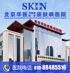 北京協和醫院皮膚科張濤醫生:銀屑病的誘因有哪些