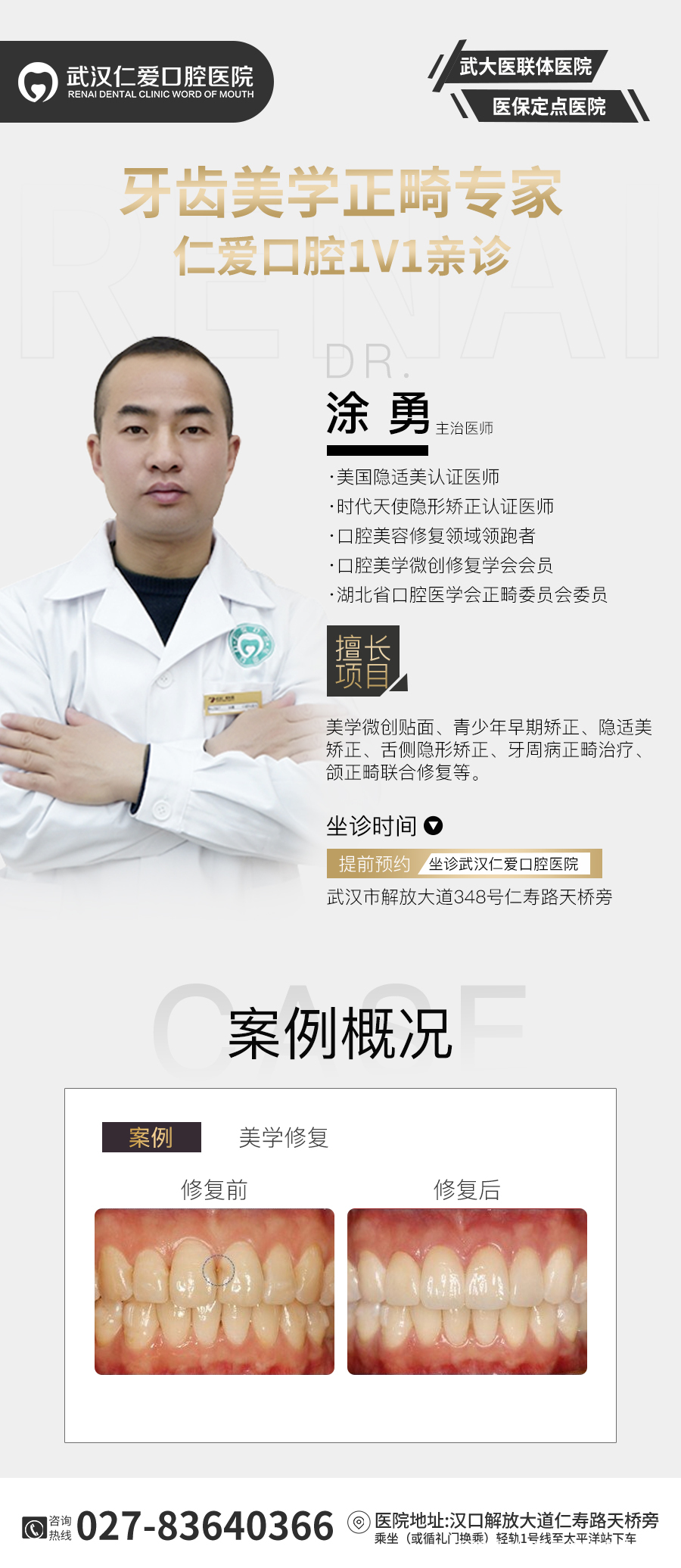 武漢仁愛口腔 數字化即刻美學貼面案例分享