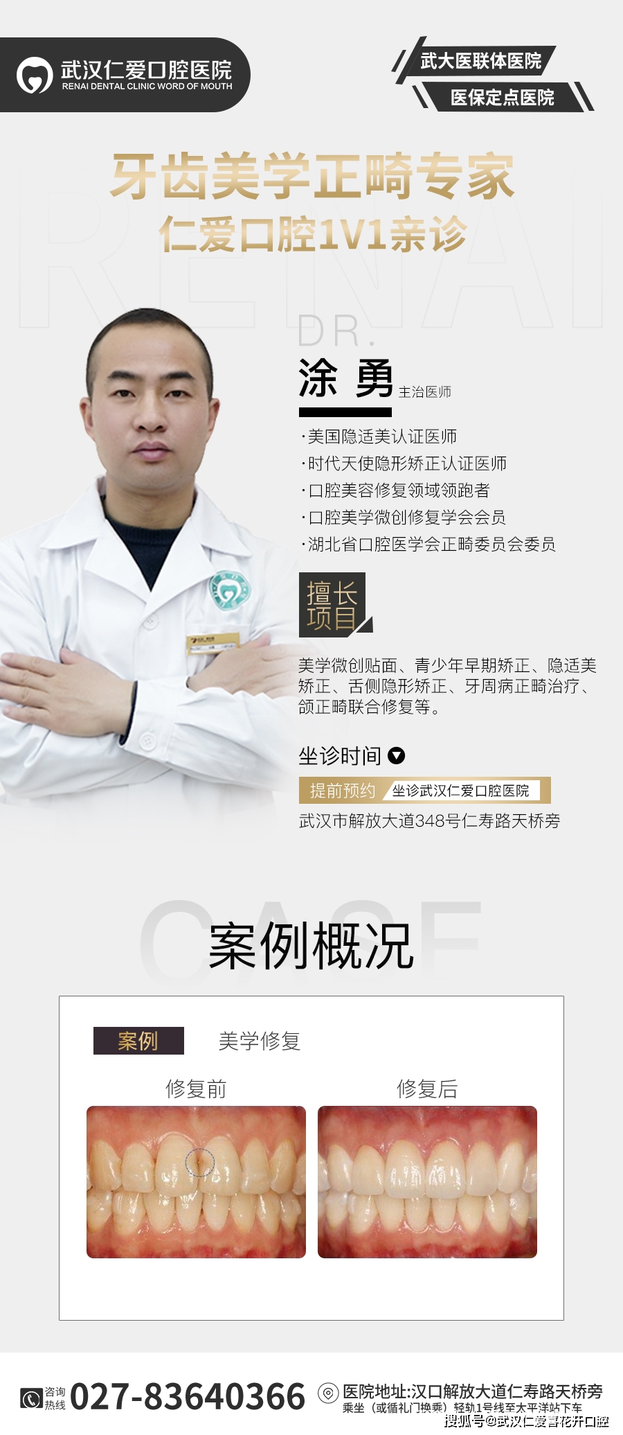 武漢仁愛口腔 數(shù)字化即刻美學(xué)貼面案例分享