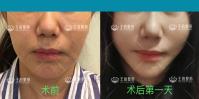 45歲后我開始研究起了“王的整形內(nèi)窺鏡駐顏術(shù)”