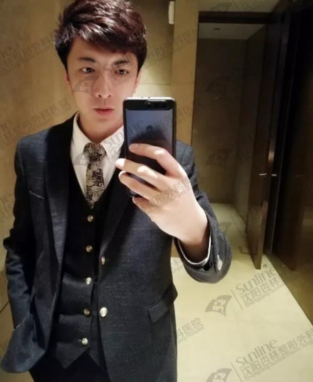 沈陽杏林整形外科醫院:下頜后縮怎么辦