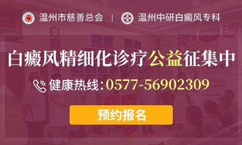 臺州白癜風醫院好不好?白斑容易發生在哪些部位