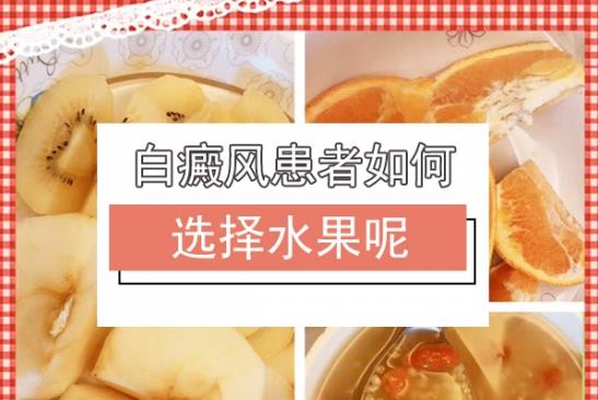白癜風醫生雷安萍:白癜風患者吃橘子會影響病情治療嗎