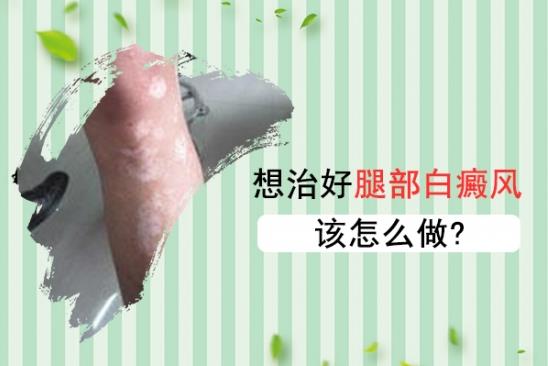 北京治療白癜風醫院王家懷醫生:如何治好腿部白癜風呢?