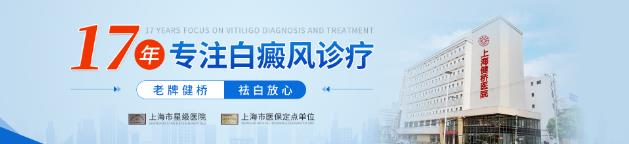 上海健橋醫院皮膚科怎么樣?白癜風怎么治療?