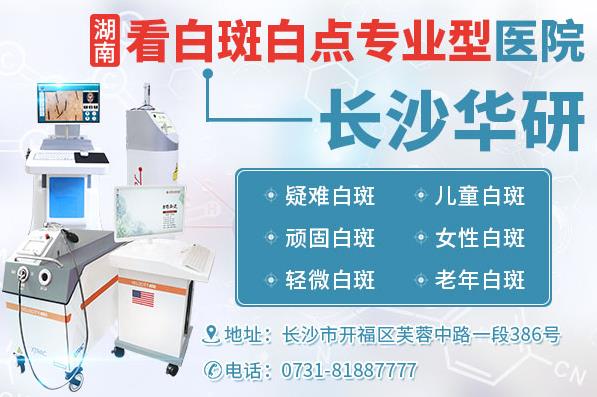 長沙華研皮膚病醫院治白可以嗎