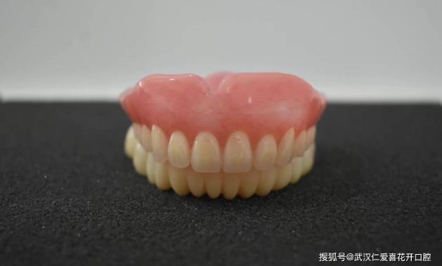 武漢口腔醫(yī)院修復(fù)案例像種植牙一樣“穩(wěn)固”的活動假牙