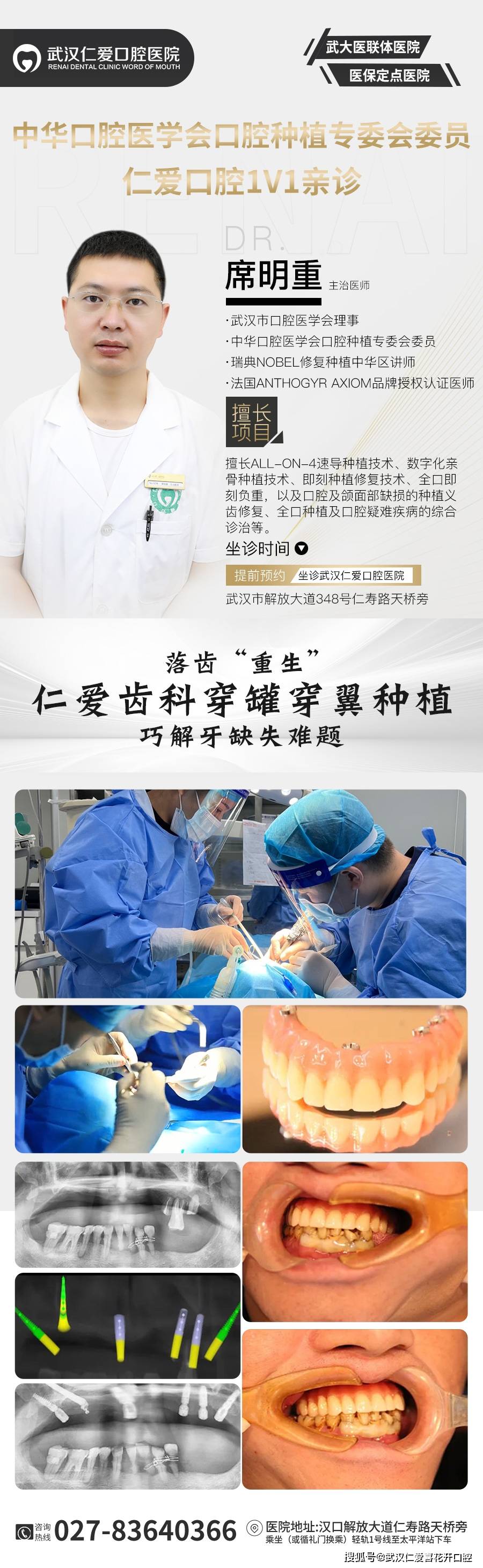 武漢口腔醫(yī)院修復(fù)案例像種植牙一樣“穩(wěn)固”的活動假牙
