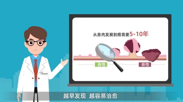 腸癌,早期癥狀就是沒有癥狀!