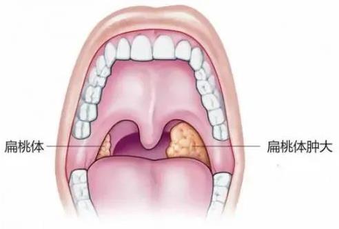 成都民生耳鼻喉醫院技術好嗎 看病效果咋樣
