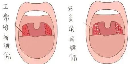 成都民生耳鼻喉醫院技術好嗎 看病效果咋樣