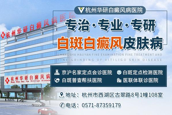杭州華研白癜風醫院治療的好嗎?