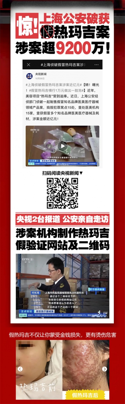 福州海峽整形攜手熱瑪吉廠家開展福建首屆凍齡計劃活動圓滿成功!