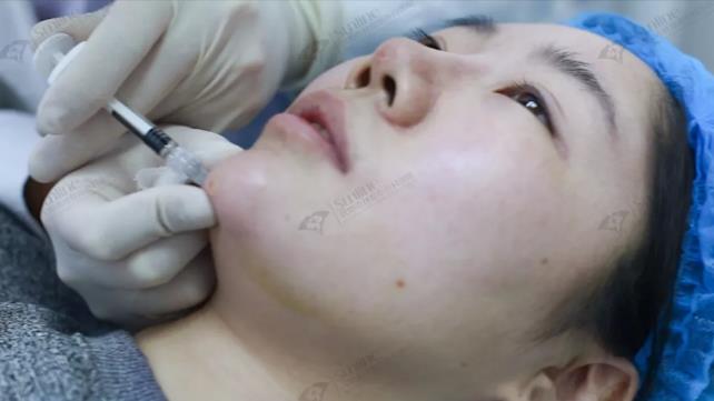 沈陽杏林整形外科醫院:國產玻尿酸和進口玻尿酸哪個好?
