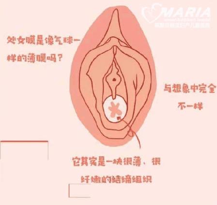 成都哪里醫院做處女膜修復正規?
