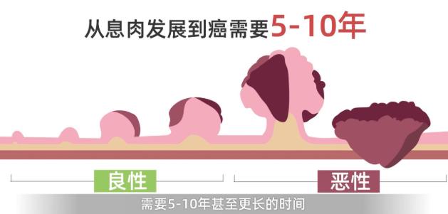 互聯網+糞便基因檢測打造腸癌居家早篩新方式