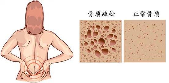 重慶哪個骨科醫(yī)院好-重慶看關(guān)節(jié)炎哪里好?重慶紅樓醫(yī)院