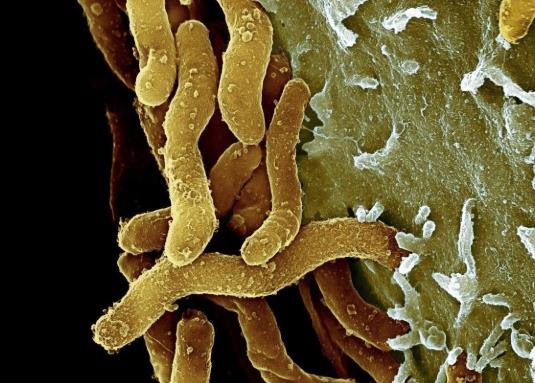 胃病是因為感染了幽門螺桿菌嗎?查幽門螺桿菌怎么查