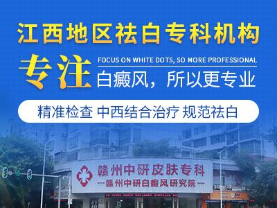 贛州中研白癜風研究院口碑好 白癜風患者真的不用補維生素C嗎? 400-300-1.jpg