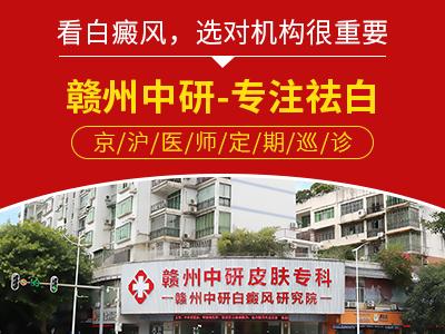 贛州中研白癜風醫院趙玉華醫生上班時間 白癜風具體檢查有哪些? 400-300-5.jpg