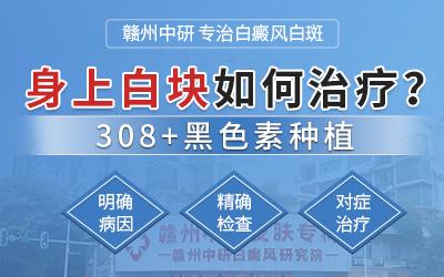 贛州中研白癜風醫院評價好嗎?孕婦患上白癜風能治嗎? 400-250-4.jpg