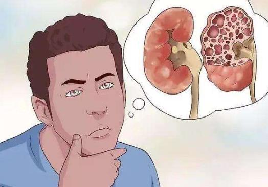 長期喝檸檬水可以降尿酸嗎?為什么減肥加節食尿酸反而高了