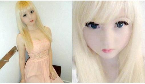 白化病女孩網絡受吹捧 導致白化病的原因有哪些