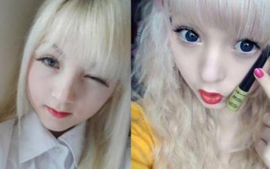 白化病女孩網絡受吹捧 導致白化病的原因有哪些