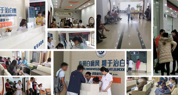 南通白癲風醫院【名醫會診公告】上海名醫秦立模會診南通復大
