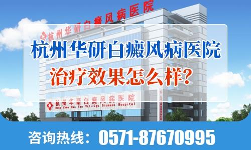 杭州華研白癜風病醫(yī)院治療效果怎么樣?