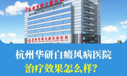 杭州華研白癜風病醫(yī)院治療效果怎么樣?