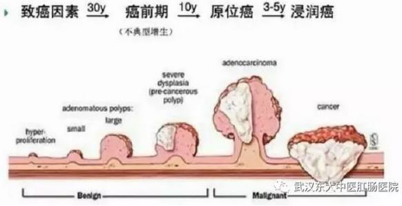 武漢東大肛腸醫院:記得重視腸道檢查