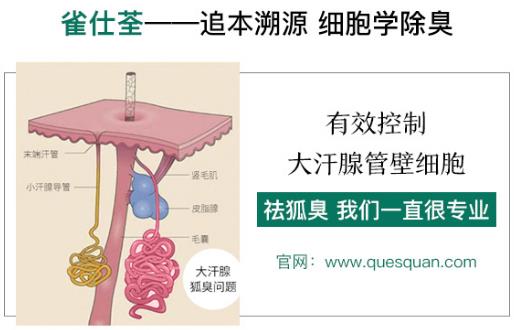 治狐臭最好的藥是哪個(gè) 讓您更專業(yè)的得到清香