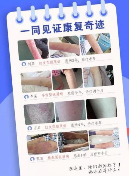 長春華山皮膚病醫(yī)院誠邀葛蒙梁教授坐診第13次聯(lián)合會診