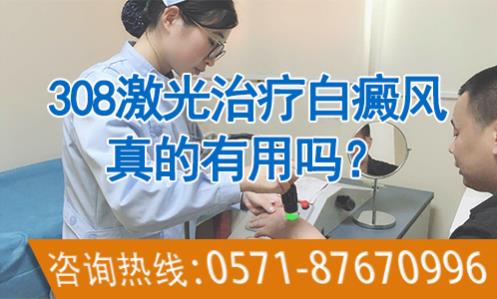華研白癜風醫院的308激光治療效果怎么樣?前端技術,值得相信