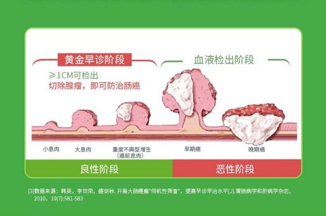 康立明生物:腸癌篩查早做早安心,不給健康留隱患