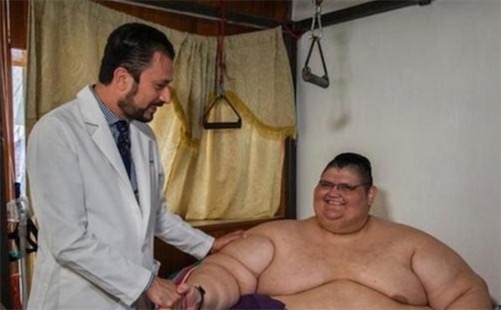 墨西哥最胖的人 Juan Pedro Franco體重曾達半噸