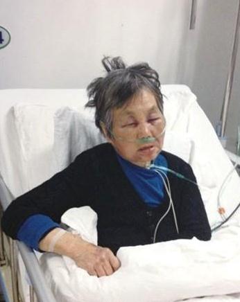 教授醉酒耍酒瘋殘忍毆打7旬老人令人發指,被打老人昏迷大小便失禁