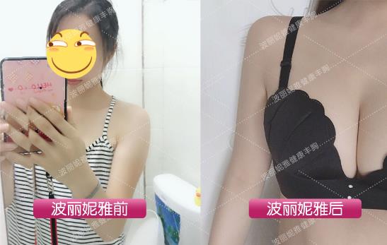 斷奶后胸變小怎么辦?辣媽必知的產后高效豐胸法!