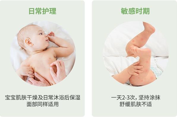 夏季嬰兒濕疹反復(fù)發(fā)作的解決方略|嬰兒身體乳選對了嗎?