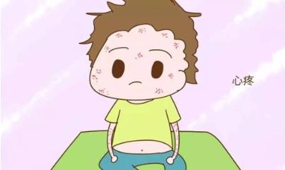 嬰兒濕疹怎么好得快,媽媽們點(diǎn)進(jìn)來