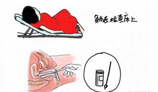 宮頸刮片檢查什么 宮頸刮片正常值